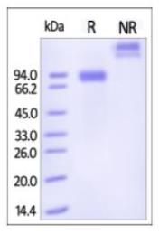 SDS-PAGE (SIGLEC6-339H).jpg